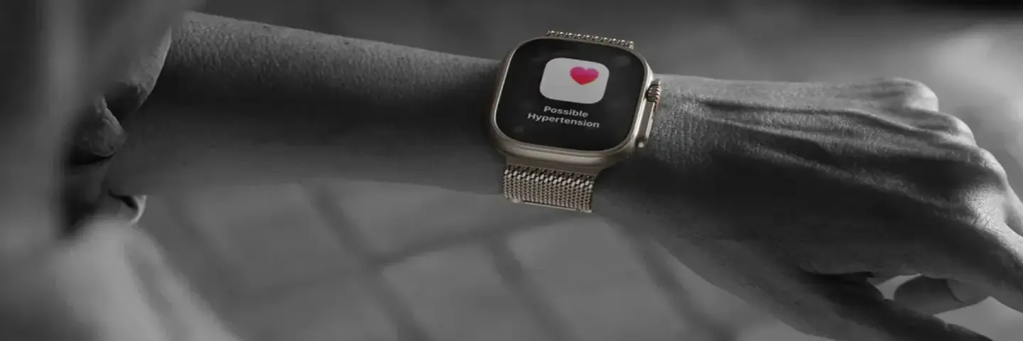 اپل واچ در نقش ابزار علمی سنجش خواب؛ از گجت روزمره تا دستگاه تحقیقاتی هوشمند